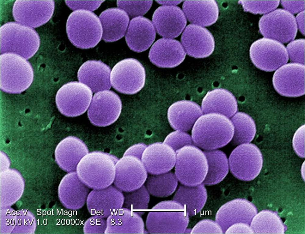 الكشف عن كلوفيباكتين: مضاد حيوي جديد من أعماق المادة المظلمة البكتيرية