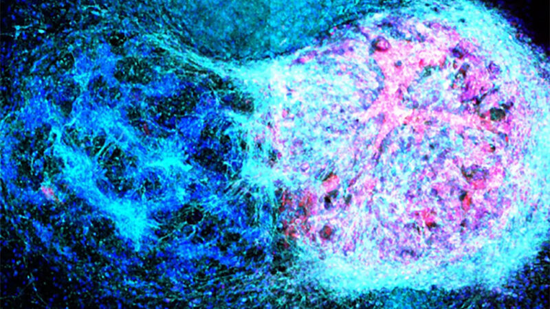 تقدم في الطباعة ثلاثية الأبعاد للخلايا العصبية يوفر الأمل في علاج إصابات الدماغ